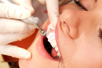Гигиеническая чистка зубов: профессиональная гигиена полости рта