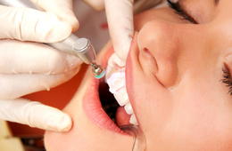 Гигиеническая чистка зубов: профессиональная гигиена полости рта