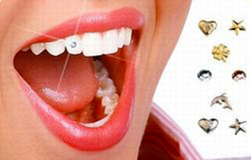 ⁠Скайсы- зубные украшения, изящные тонкие, плоские почти невесомые стразы. Приклеиваются на поверхность зубов без нарушения целостности эмали.