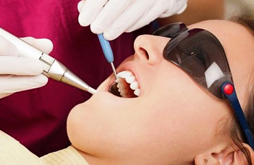 Лечение кариеса зубов по новым технологиям с использованием материалов последнего поколения.